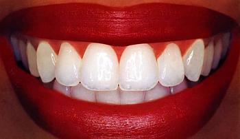 Dentists Gnash Teeth-teethwhite.jpg